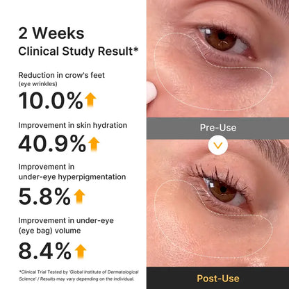 Jelly Eye Mask - Kojic Acid & Vitamin C Formula For Brighter-Looking Eyes