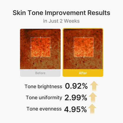 Korean Brightening Skincare Set - Kojic Acid + Turmeric Formula For A Radiant Glow