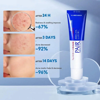 Blemish Care Cream - Japanese Medicated Formula For Clearer-Looking Skin