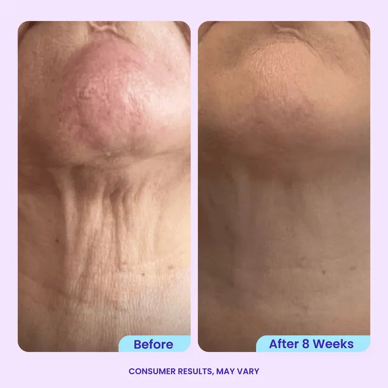 Neck Tightening Cream - Hydrating Firming Formula For Smooth Looking Skin