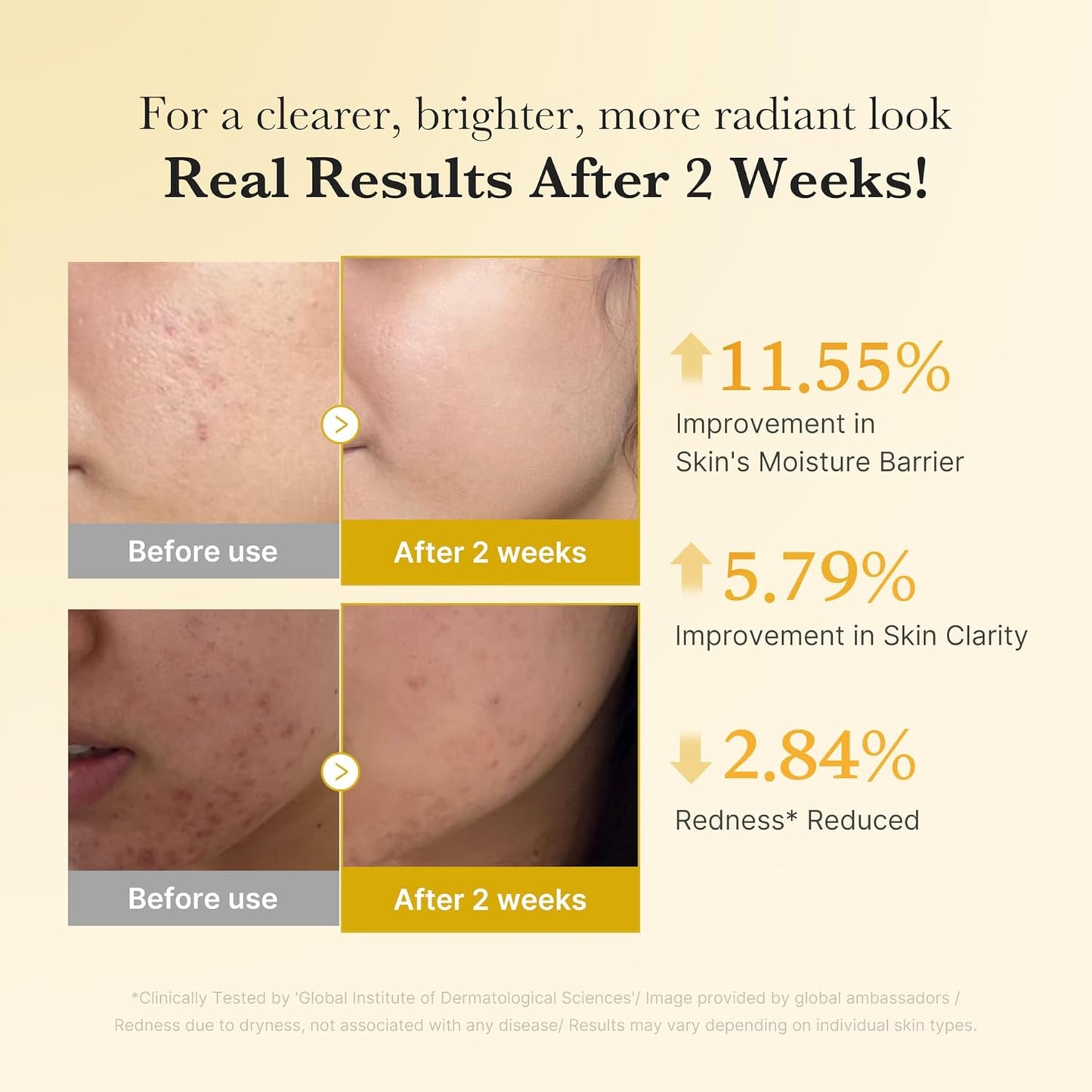 Korean Brightening Skincare Set - Kojic Acid + Turmeric Formula For A Radiant Glow