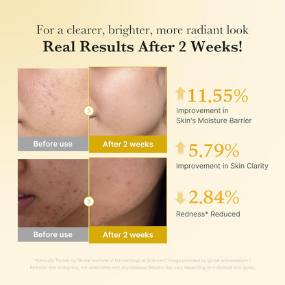 Korean Brightening Skincare Set - Kojic Acid + Turmeric Formula For A Radiant Glow