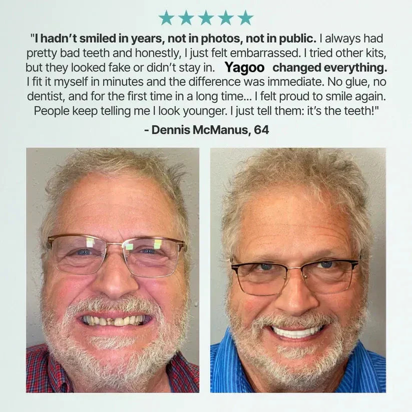 🌎Ends Today: 79% OFF! Medical Full Denture with Strong Suction