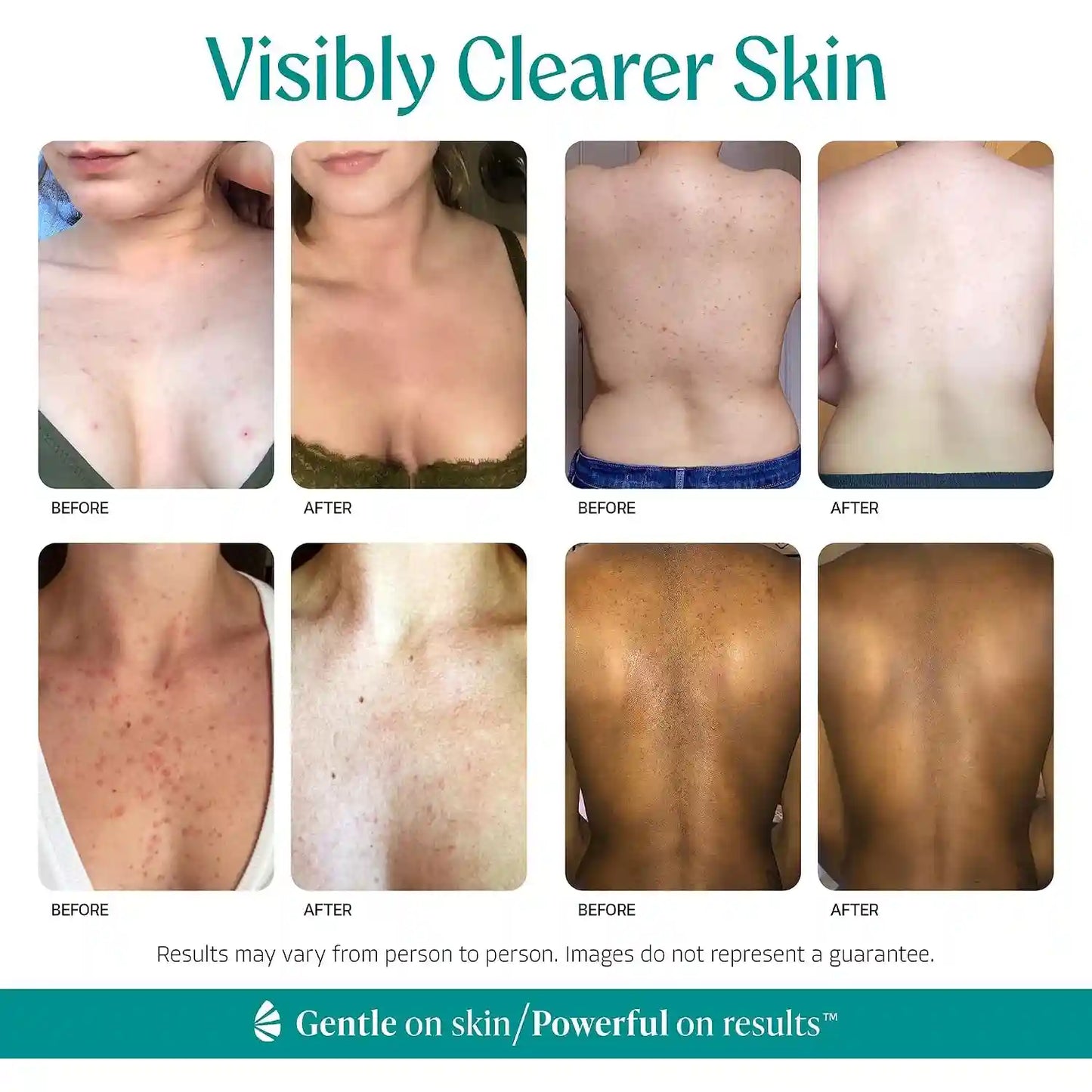 Body Clearing Serum - 15% Mandelic Acid Formula For Smooth & Refined-Looking Skin